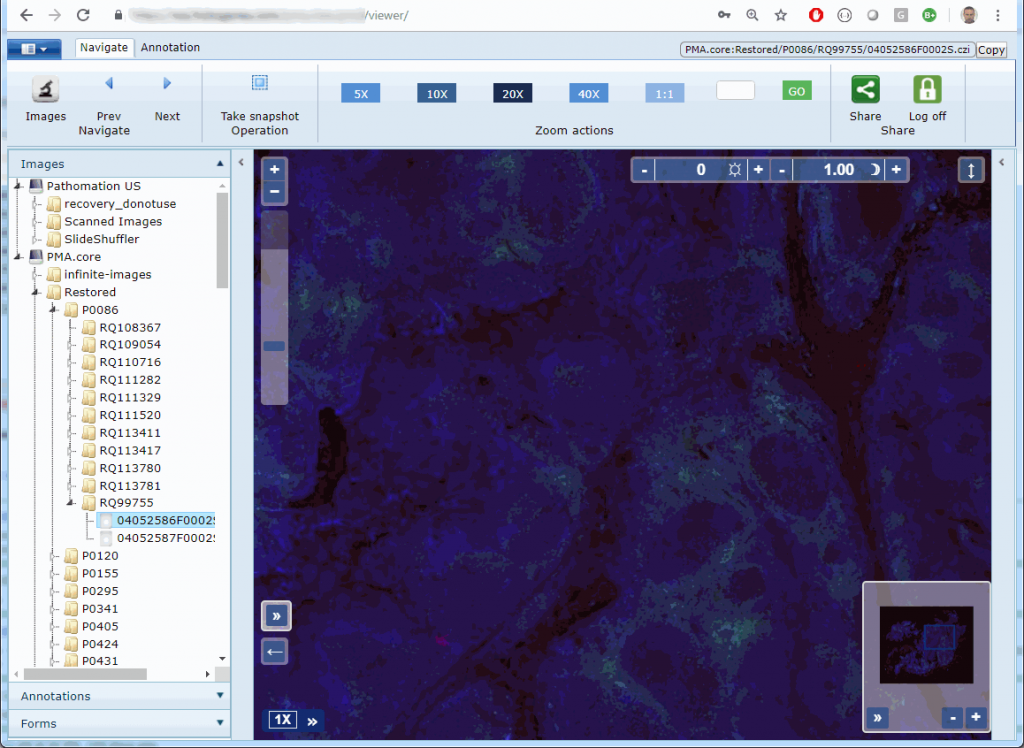 A Look At Pmaview Real Data